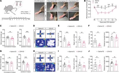 Microglial Engulfment of Spines in the Ventral Zona Incerta Regulates Anxiety-Like Behaviors in a Mouse Model of Acute Pain